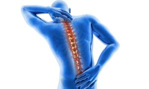 spinal pain image